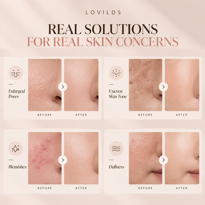✨LOVILDS® Lightweight CC Tinted Serum – Buildable, Natural-Looking Coverage